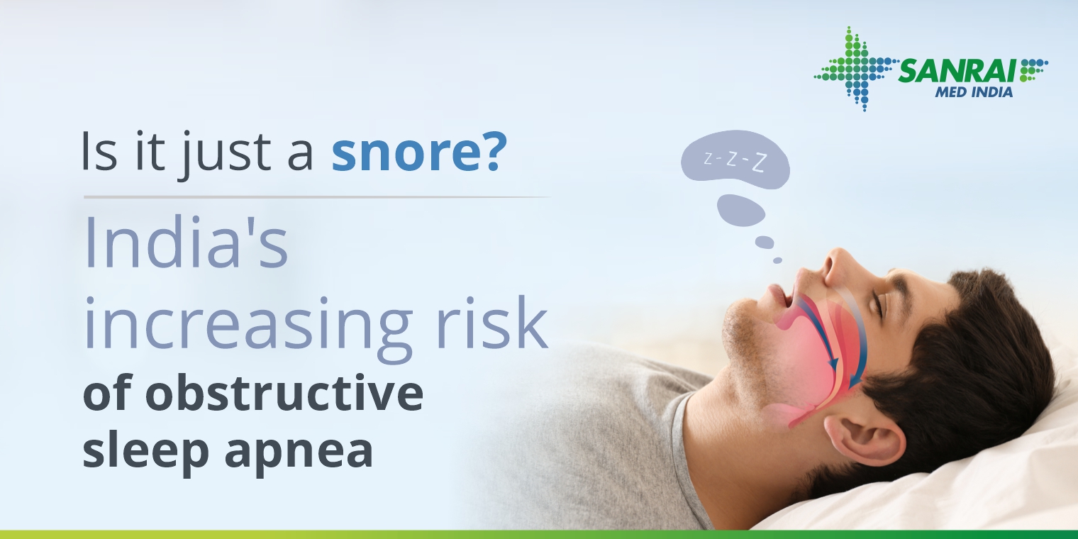 The Increasing risk of obstructive sleep apnea in India